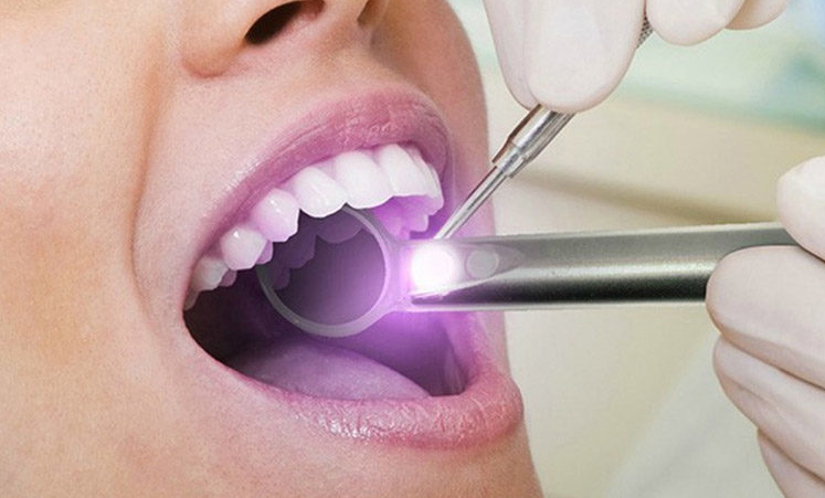 Mouth screening for oral cancer
