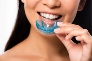 A woman uses a mouthguard as preventative dentistry